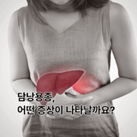 담낭용종